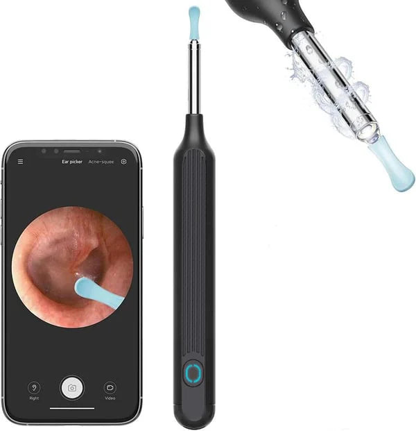 🔥Last Day Promotion- SAVE 65% OFF🔥 1080P Ear Wax Removal Camera