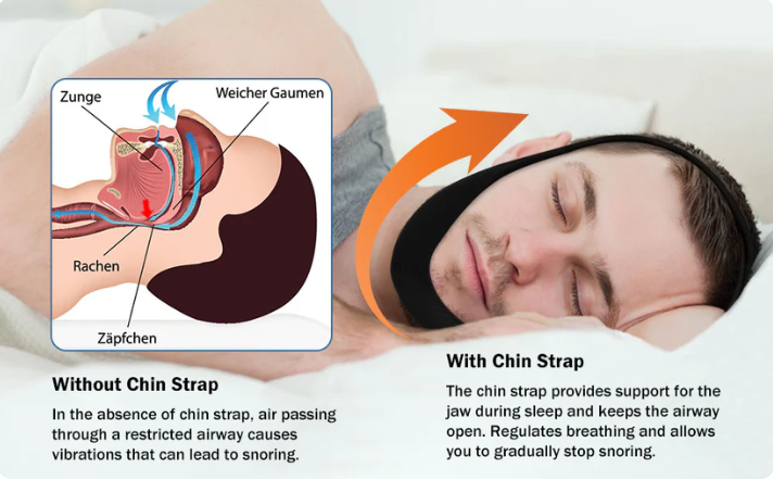 💥BUY 1 GET 1 FREE [ONLY TODAY] 💥AirFlow Jaw Strap